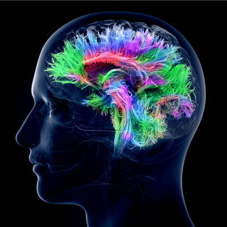EMDR 4